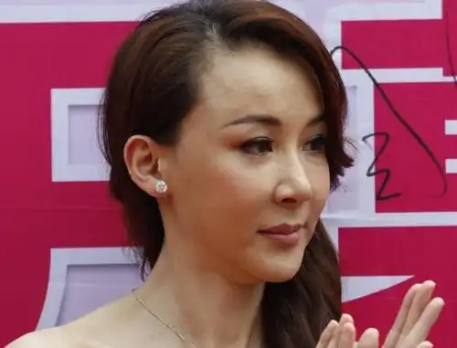 整容失败的五位女星,第一个成"反面教材",最后一个真的太可惜