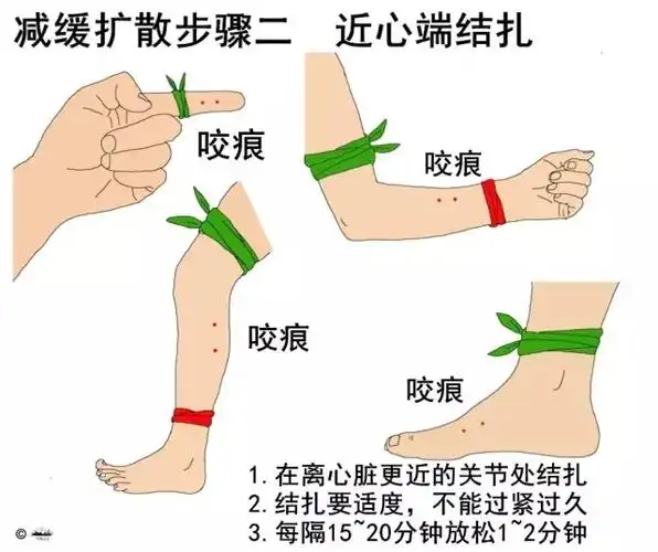 被蛇咬了怎么办? - 知乎