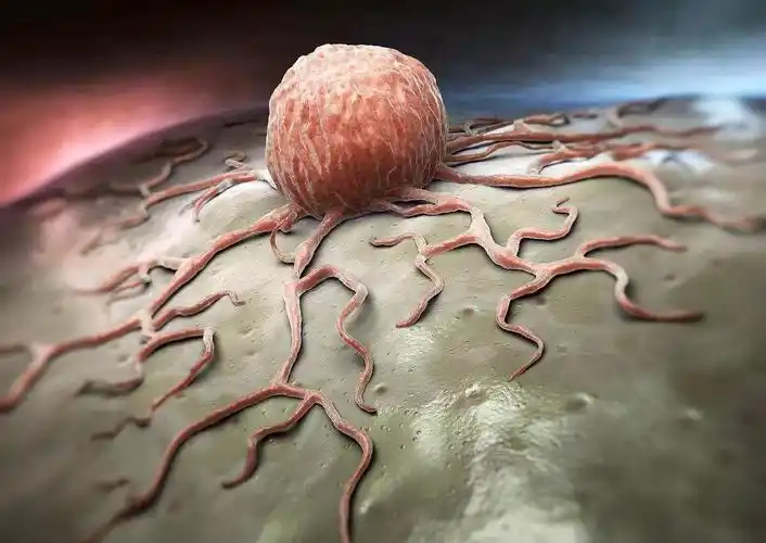 干货|良性肿瘤和恶性肿瘤有什么区别?