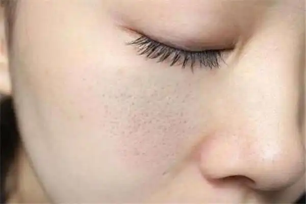 毛孔粗大用什么洗面奶