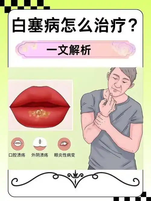 典型症状:溃疡固定不移,创面紫暗,伴有局部刺痛,皮肤瘀斑,舌有瘀点或