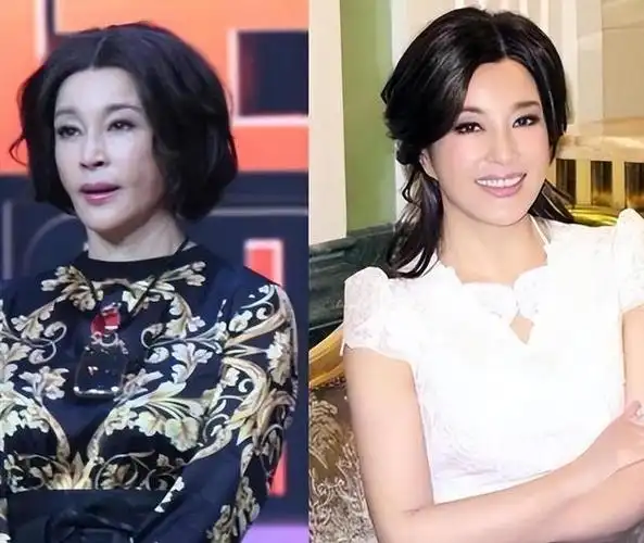 女明星们在面对美丽时,究竟是选择自然老去还是借助医美手段永葆青春