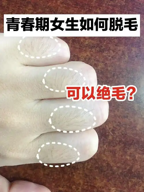 94 可能像我这样手上长汗毛的女生不多吧?