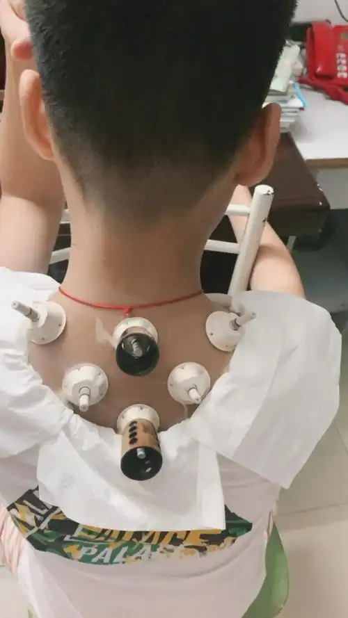 给家里的仨宝艾灸颈椎,美美的一觉到天亮99