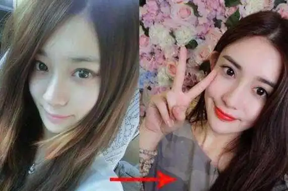 整容孟子义整容过吗整过哪整容前后照片大曝光