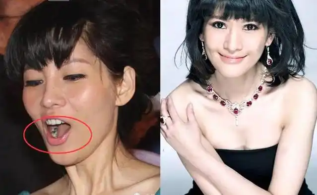 率,号称主持第一美女,但在某一次活动上被记者拍到牙齿的一片小黑洞