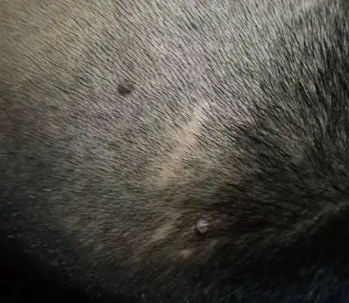 请问头上这个是瘊子还是脂肪粒,可以手术切除吗?