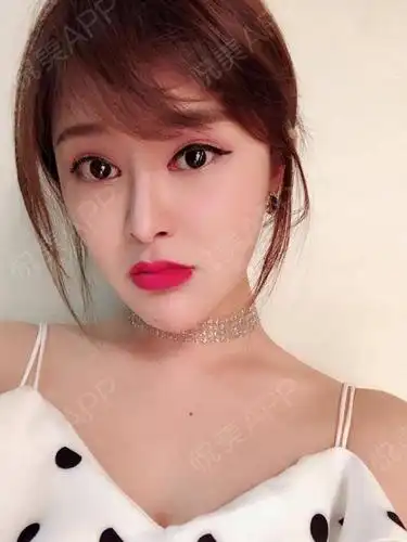 鼻部多项_悦美整形