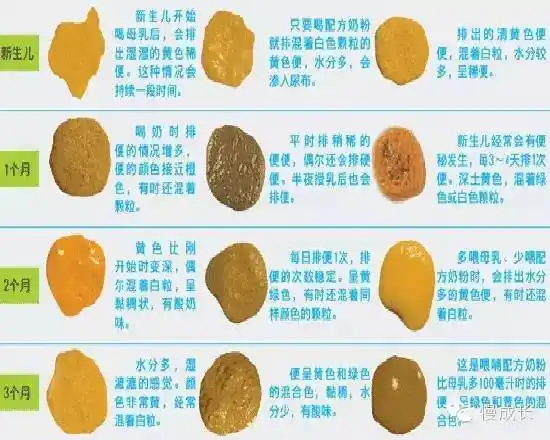 11个月宝宝便便颜色(bb便便颜色健康晴雨表)