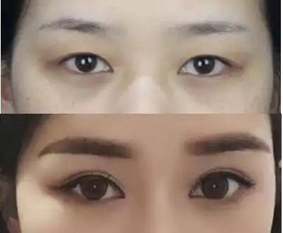 这5种眼睛不做双眼皮,会很难看!