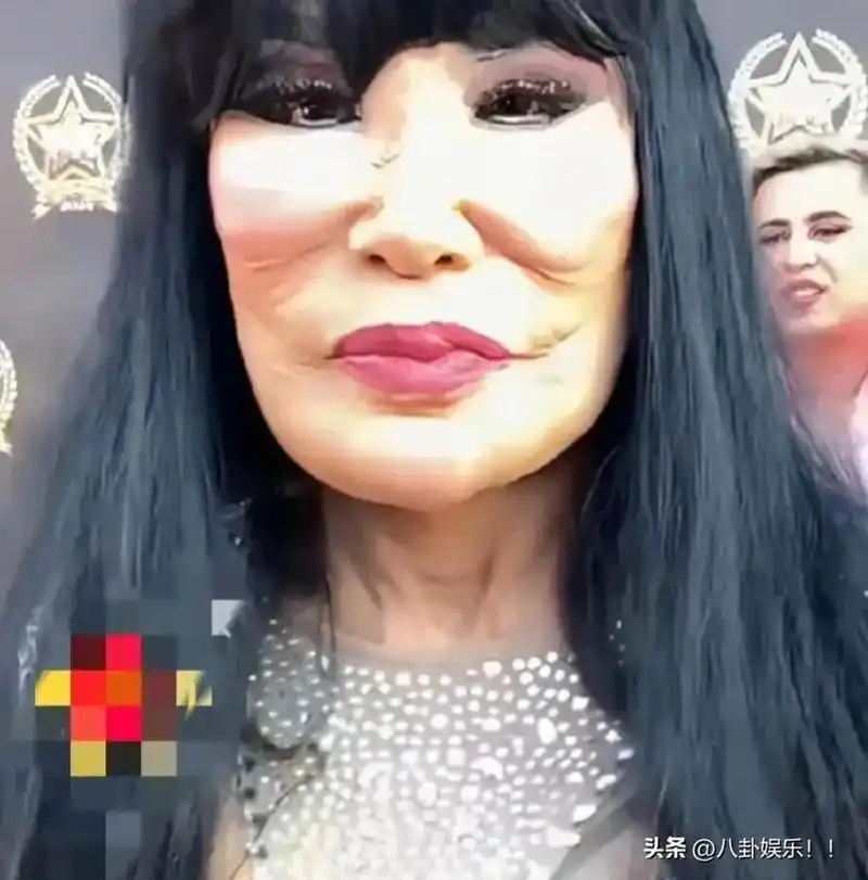 天哪这整容后遗症吓死人了!