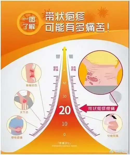 二一五医院:痛到"怀疑人生",多学科联合降服带状疱疹|带状疱疹_新浪