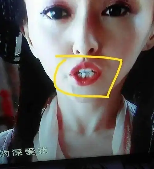唐嫣的整牙历程,一口龅牙原来是这样一点点变齐的!