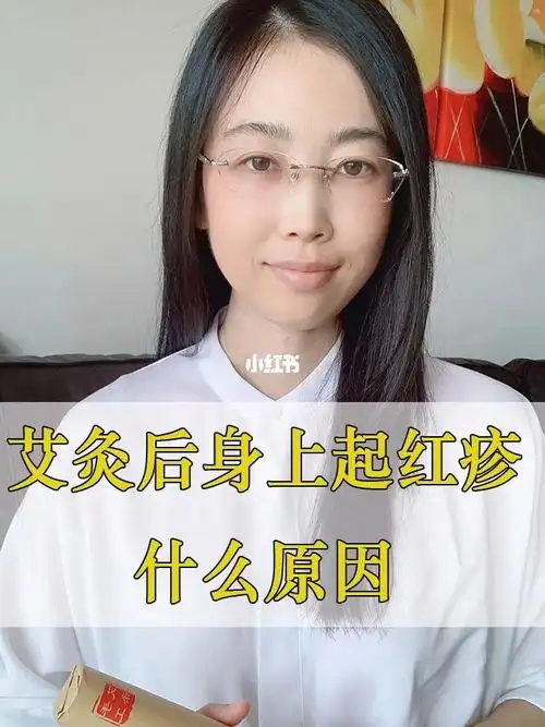艾灸后身上起红疹是什么原因,艾灸后起疹子怎么回事 #艾灸   #红疹