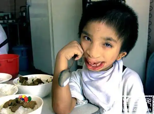 越南很多长相怪异的畸形儿,原来是美国人干的