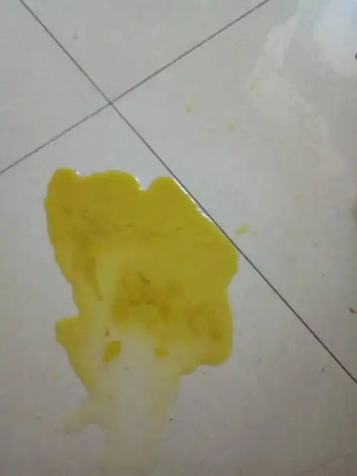 15个月女宝,今早起床开始拉肚子,黄色的水是什么原因?着凉还是消化
