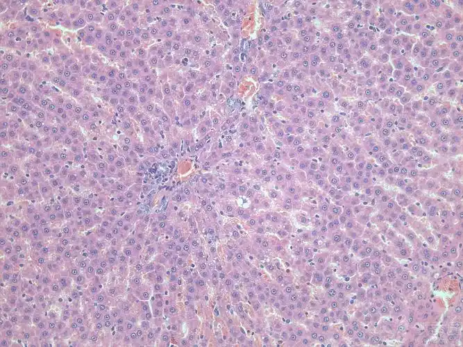 【讨论】肝脏he染色可以看出肝硬化和脂肪肝吗?