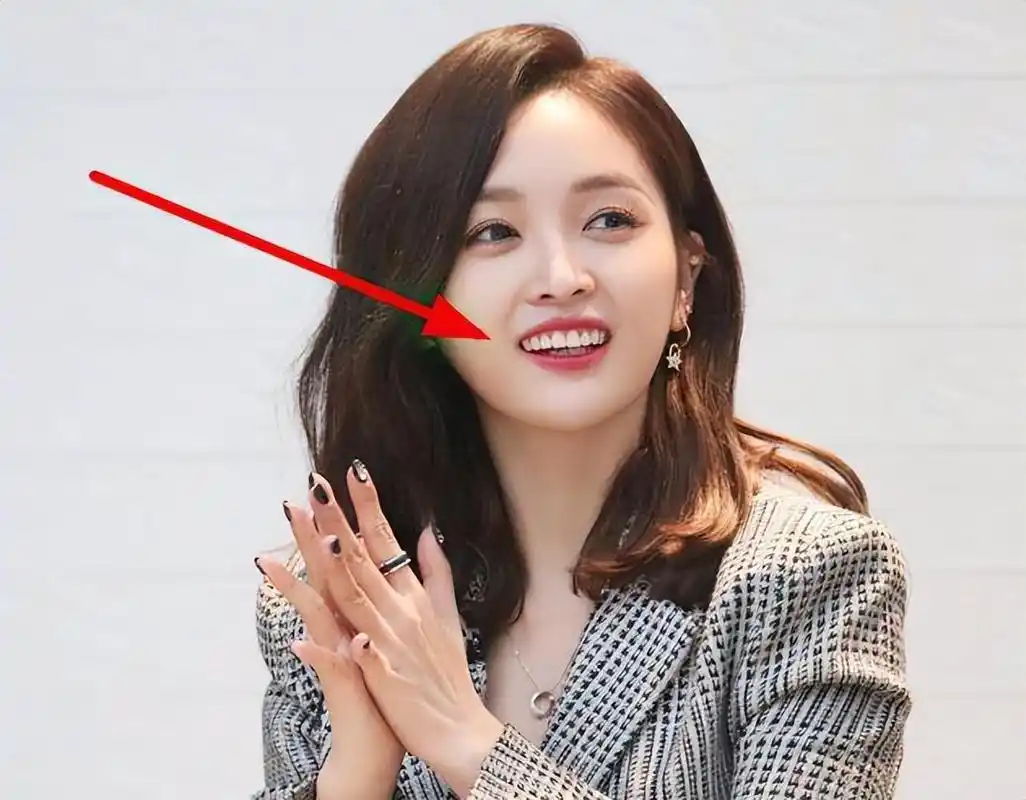 女明星"假牙"大pk,谁的嘴巴闭不上,谁的嘴里藏着一套房?