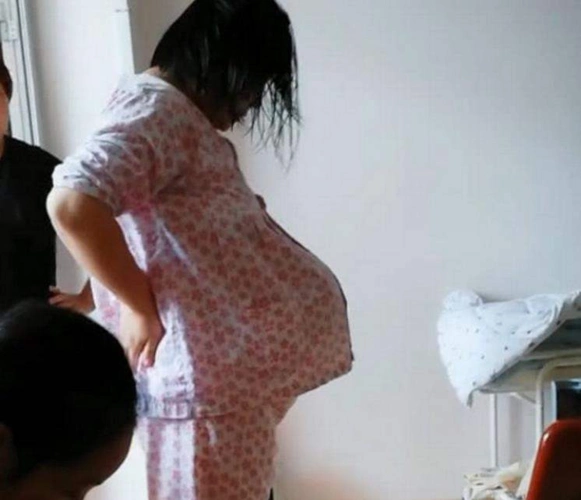 孕妇可观的腹部不是大,而是"独一无二"悬浮肚:再大点容易炸开|肚子