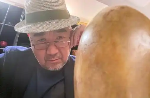 张国立爬山被路人拍下可怕后脑勺头发快掉光露出大块头皮