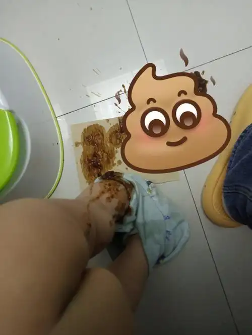 前提:我闺女之前都是三四天才拉屎过程:尝试了各种办法,加菌加水加