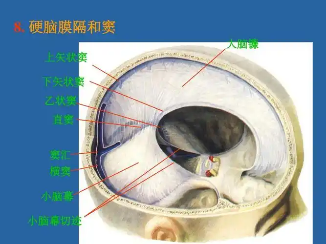 硬脑膜隔和窦 大脑镰 上矢状窦 下矢状窦 乙状窦 直窦 窦汇 横窦