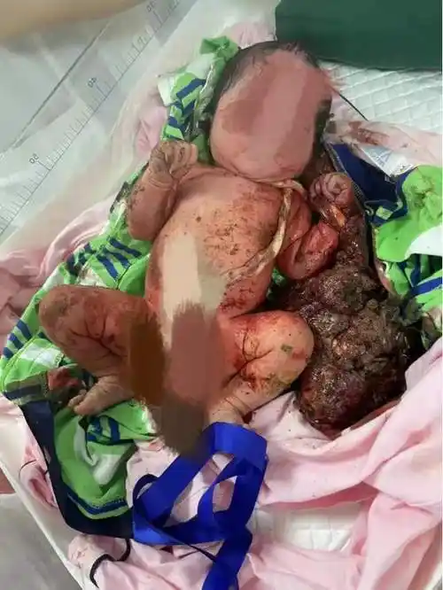 广州天河新生婴儿被遗弃全城用爱心托起生命方舟