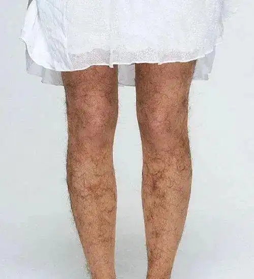 女生腿毛"又长又黑"是怎样的体验?为什么有的女生腿毛很浓密?