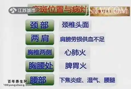 背部,颈肩最适合刮痧,每个部位最多刮30下.慢刮为补,快刮为泻.