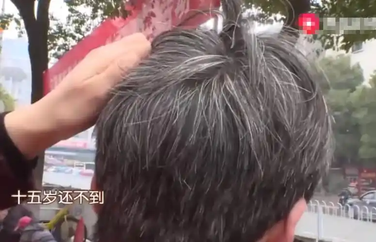 14岁男孩满头白发,母亲四处求医,专家的话让其愣住了