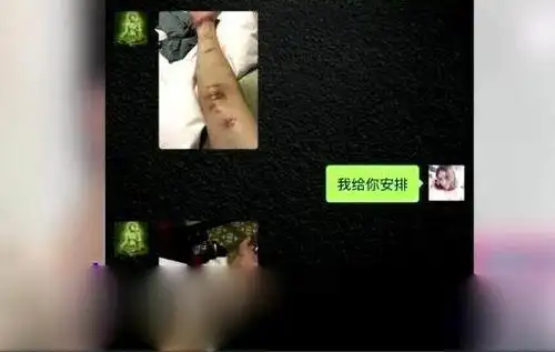 身体早已被自己折磨成千疮百孔,自杀或许是kimi最好的解脱