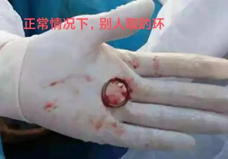 当你准备放弃的时候,可以再坚持一下.上午一个绝经3年,上环3 - 抖音