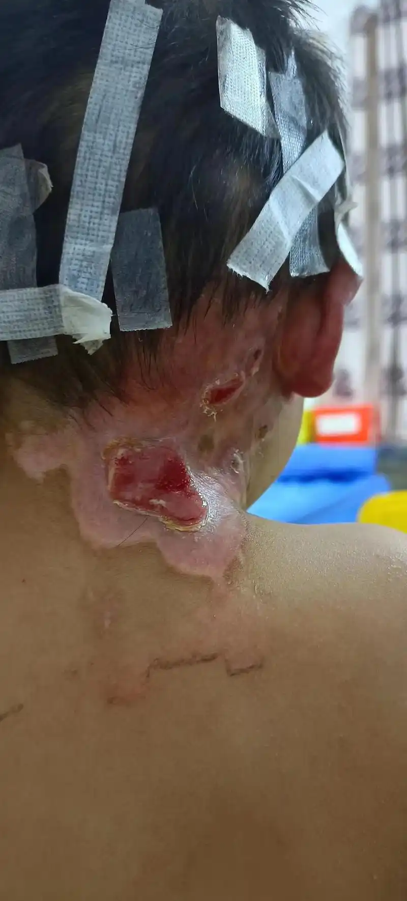 也许只有当妈的才会担心你的以后,你的伤疤,伤口慢慢的一天比一 - 抖