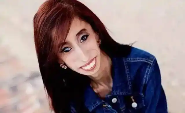 被说"全世界最丑的女人",17岁遭遇网暴,她的做法却出人意料_lizzie