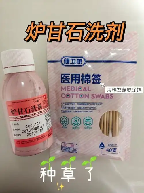 4m17d 蚊子叮咬后续&消肿神器炉甘石洗剂