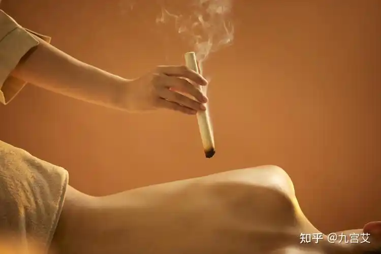 艾灸虽好,但也会有一定的副作用?这样做完美避开雷区