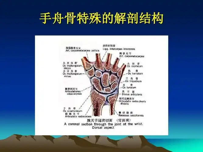 手舟骨骨折的治疗.