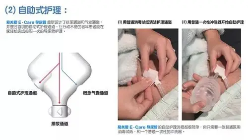 另一方面,为了加强老人对导尿管的清洁意识,便捷护理