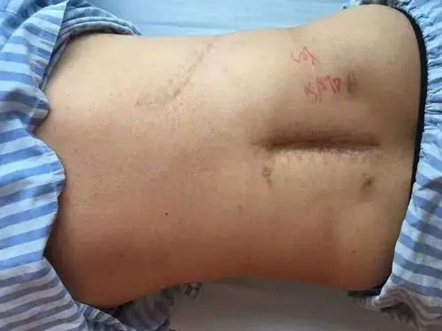 "医生,帮我想想办法,不然我就是一个废人了.