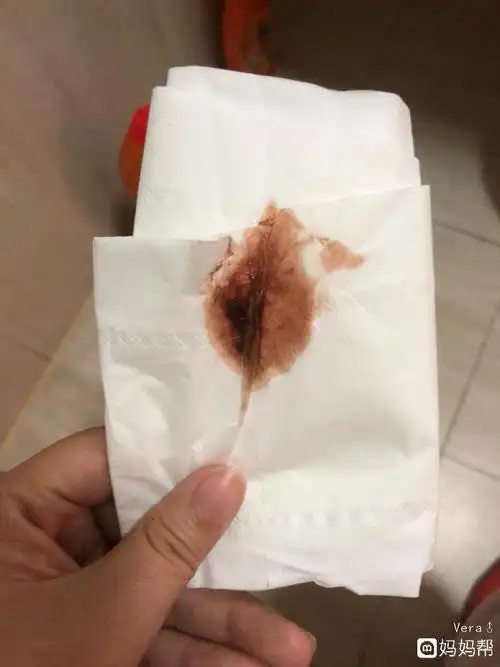 义务!着床成功后出血图片"福禄寿喜"-第1张图片-万宝网