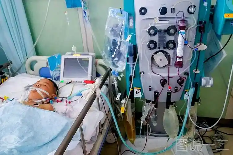 重症监护室苦撑79天坚强娃截肢后要当画家