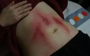 女人经常刮痧原来有这么多的好处