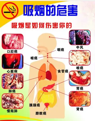 图片来自于网络,如有侵权,立即删除.
