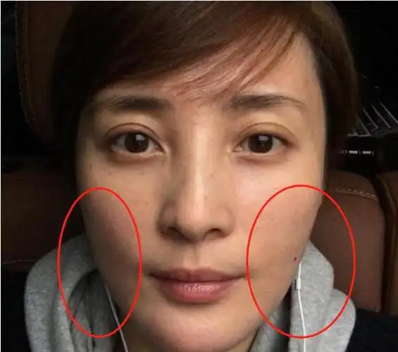 蒋勤勤整容反面教材,开局就是王炸,一手好牌打得稀烂|杨幂|陈数_网易