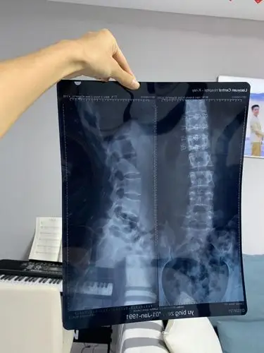 腰痛,拍了个片子,请大神帮我看一下,有什么问题么