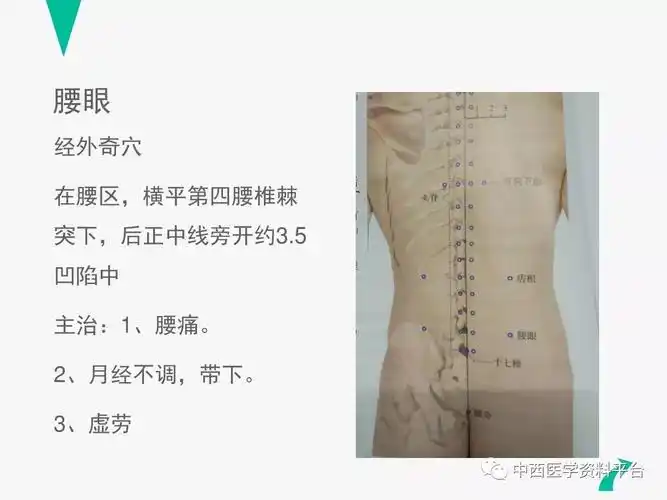 腰痛的针灸治疗