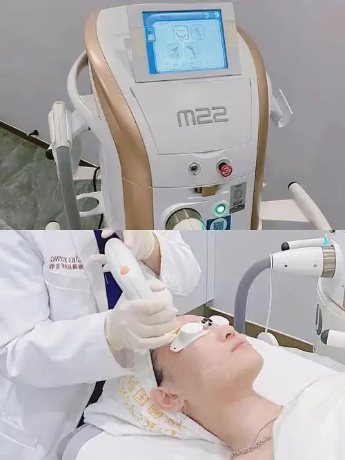 光子嫩肤m22超光子真香感觉脸都嫩拉