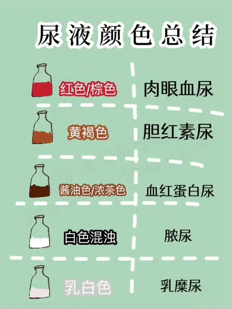 护考考点尿液颜色 7815 月亮不睡我不睡 考试中常常会考的尿液