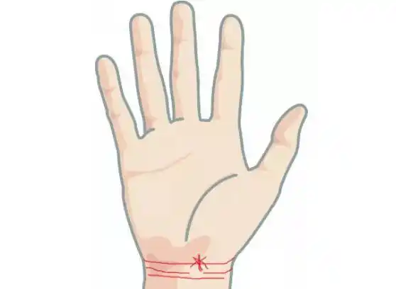 手腕线上有这四种纹路是富贵命,看看你是吗?