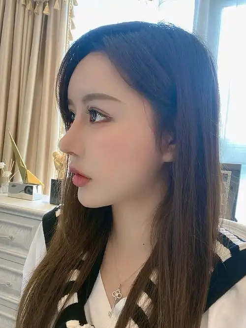 做了鼻子多久才好看鼻子真人隆鼻后的恢复过程图片比较高级感的鼻子